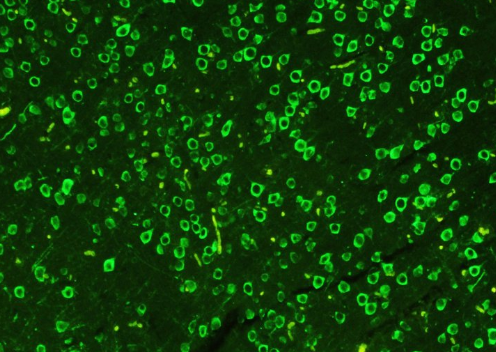 ɹFITC-Human fibrinogen Gɫɹؘ(bio)ӛѪwSԭđ(yng)