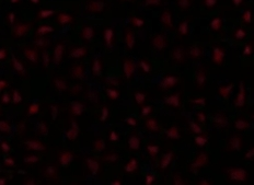 ɹ푑(yng)Ӱ֬|(zh)wƼg(sh)Fluorescently Labeled Stimuli-Responsive Imaging Liposome Customization Technology